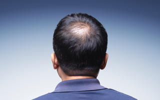 Protecting Your Scalp from Premature Aging